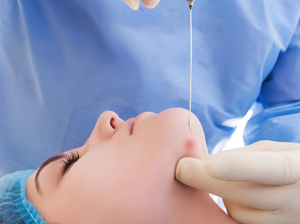 Facetite y Endolifting